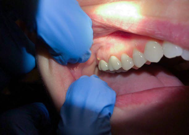 Best Cosmetic Emergency Dentistry in Cheshire Village, CT